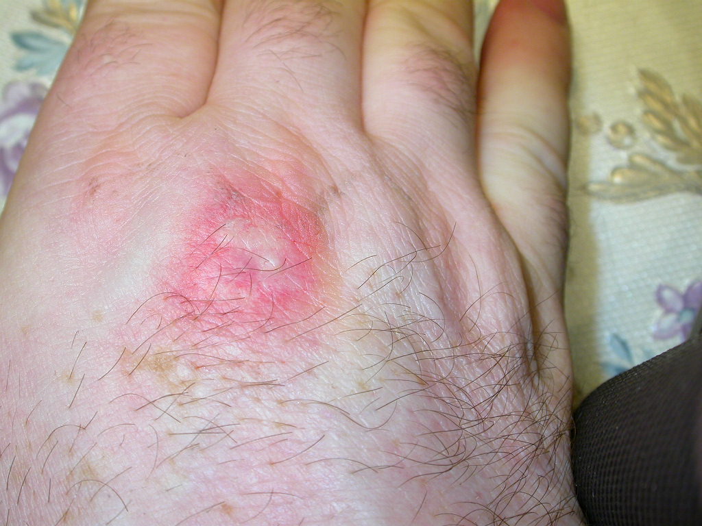 A proposito di morsi....